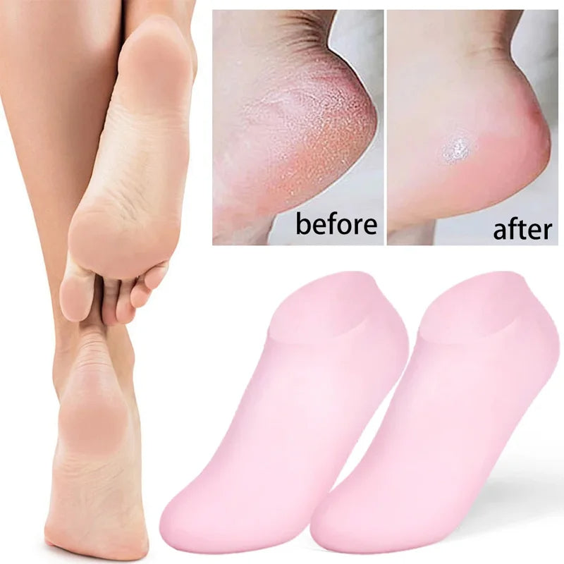 Silicone Gel Heel Socks for Cracked Heels – Moisturizing & Repair
